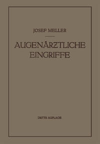 Vorderes Coverbild Augenärztliche Eingriffe