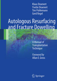 Vorderes Coverbild Autologous Resurfacing and Fracture Dowelling