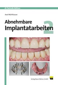 Vorderes Coverbild Abnehmbare Implantatarbeiten 2