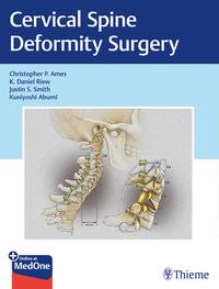 Vorderes Coverbild Cervical Spine Deformity Surgery