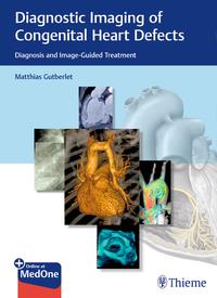 Vorderes Coverbild Diagnostic Imaging of Congenital Heart Defects