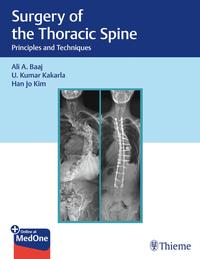 Vorderes Coverbild Surgery of the Thoracic Spine