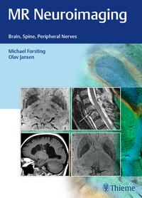 Vorderes Coverbild MR Neuroimaging