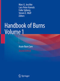 Vorderes Coverbild Handbook of Burns Volume 1