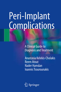 Vorderes Coverbild Peri-Implant Complications