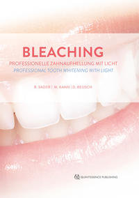 Vorderes Coverbild Bleaching
