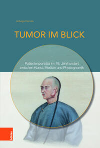 Vorderes Coverbild Tumor im Blick