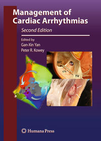 Vorderes Coverbild Management of Cardiac Arrhythmias