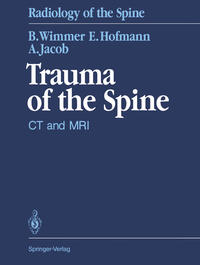 Vorderes Coverbild Trauma of the Spine