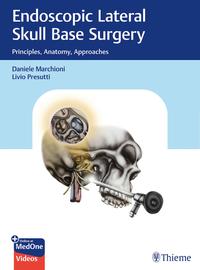 Vorderes Coverbild Endoscopic Lateral Skull Base Surgery