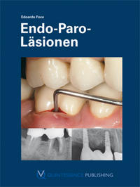 Vorderes Coverbild Endo-Paro-Läsionen