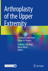 Vorderes Coverbild Arthroplasty of the Upper Extremity