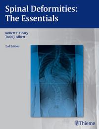 Vorderes Coverbild Spinal Deformities