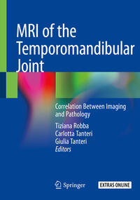 Vorderes Coverbild MRI of the Temporomandibular Joint