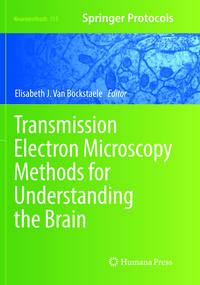 Vorderes Coverbild Transmission Electron Microscopy Methods for Understanding the Brain