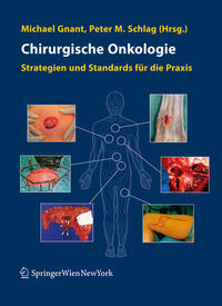 Vorderes Coverbild Chirurgische Onkologie