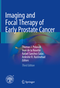 Vorderes Coverbild Imaging and Focal Therapy of Early Prostate Cancer