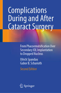 Vorderes Coverbild Complications During and After Cataract Surgery