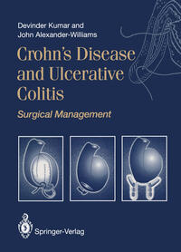 Vorderes Coverbild Crohn’s Disease and Ulcerative Colitis