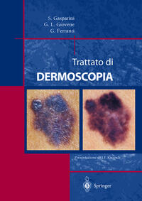 Vorderes Coverbild Trattato di Dermoscopia