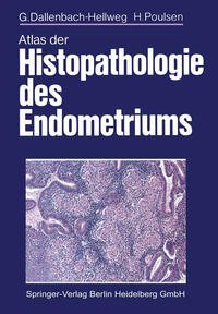 Vorderes Coverbild Atlas der Histopathologie des Endometriums