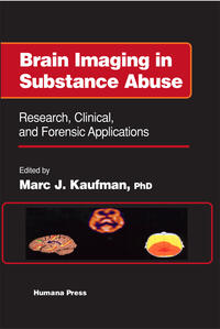 Vorderes Coverbild Brain Imaging in Substance Abuse