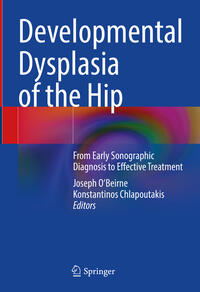 Vorderes Coverbild Developmental Dysplasia of the Hip