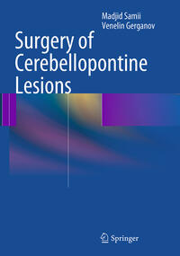 Vorderes Coverbild Surgery of Cerebellopontine Lesions