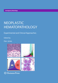 Vorderes Coverbild Neoplastic Hematopathology