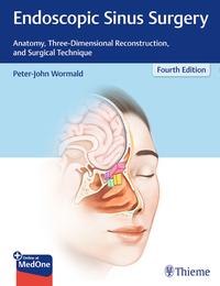 Vorderes Coverbild Endoscopic Sinus Surgery
