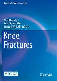 Vorderes Coverbild Knee Fractures