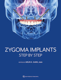 Vorderes Coverbild Zygoma Implants