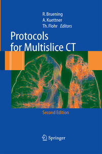Vorderes Coverbild Protocols for Multislice CT