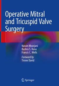 Vorderes Coverbild Operative Mitral and Tricuspid Valve Surgery