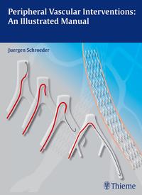 Vorderes Coverbild Peripheral Vascular Interventions: An Illustrated Manual