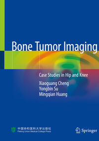 Vorderes Coverbild Bone Tumor Imaging