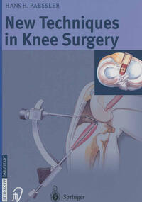 Vorderes Coverbild New Techniques in Knee Surgery