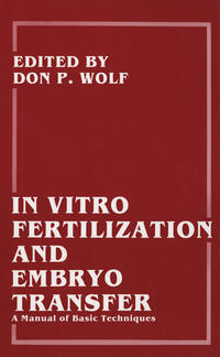 Vorderes Coverbild In Vitro Fertilization and Embryo Transfer