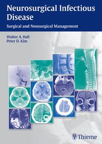 Vorderes Coverbild Neurosurgical Infectious Disease