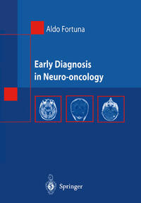 Vorderes Coverbild Early Diagnosis in Neuro-oncology