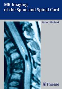 Vorderes Coverbild MR Imaging of the Spine and Spinal Cord