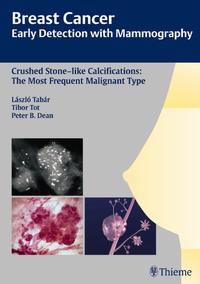 Vorderes Coverbild Breast Cancer: Early Detection with Mammography