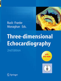 Vorderes Coverbild Three-dimensional Echocardiography