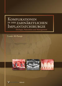 Vorderes Coverbild Komplikationen in der zahnärztlichen Implantatchirurgie