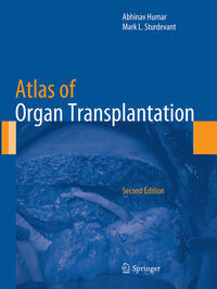 Vorderes Coverbild Atlas of Organ Transplantation