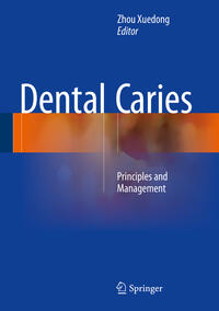 Vorderes Coverbild Dental Caries