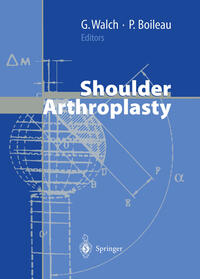Vorderes Coverbild Shoulder Arthroplasty