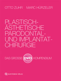 Vorderes Coverbild Plastisch-ästhetische Parodontal- und Implantatchirurgie