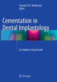 Vorderes Coverbild Cementation in Dental Implantology