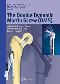 Vorderes Coverbild The Double Dynamic Martin Screw (DMS)
